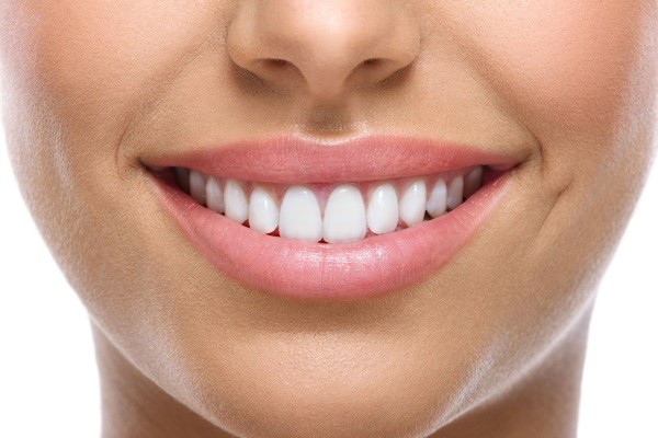 Where in Bali are good places to get veneers?